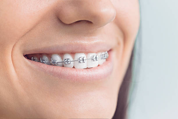 Best Traditional Braces  in Edgewood, TX